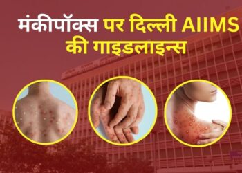 Delhi AIIMS guidelines on MonkeyPox