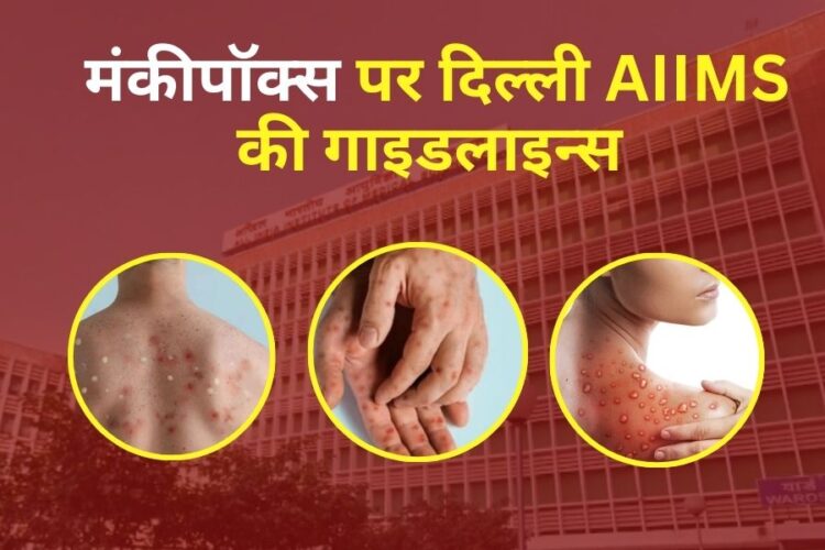 Delhi AIIMS guidelines on MonkeyPox